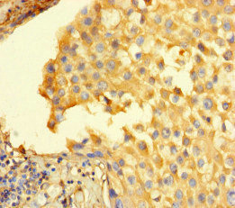 Immunohistochemistry (Formalin/PFA-fixed paraffin-embedded sections) - Anti-STIL/SIL antibody (AB222838), expandable thumbnail