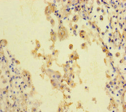 Immunohistochemistry (Formalin/PFA-fixed paraffin-embedded sections) - Anti-STIL/SIL antibody (AB222838), expandable thumbnail