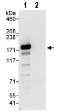 Immunoprecipitation - Anti-STIL/SIL antibody (AB89314)