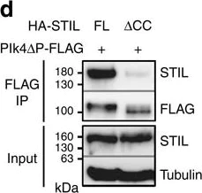 Western blot - Anti-STIL/SIL antibody (AB89314)