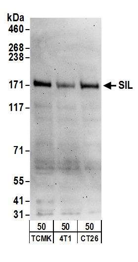 Western blot - Anti-STIL/SIL antibody (AB89314)