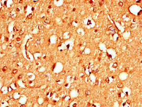 Immunohistochemistry (Formalin/PFA-fixed paraffin-embedded sections) - Anti-STIM2 antibody (AB223033)