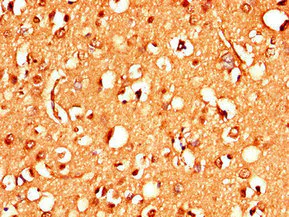 Immunohistochemistry (Formalin/PFA-fixed paraffin-embedded sections) - Anti-STIM2 antibody (AB223033)