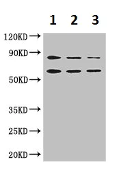 Western blot - Anti-STIM2 antibody (AB223033)