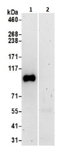 Immunoprecipitation - Anti-STIM2 antibody (AB241510)