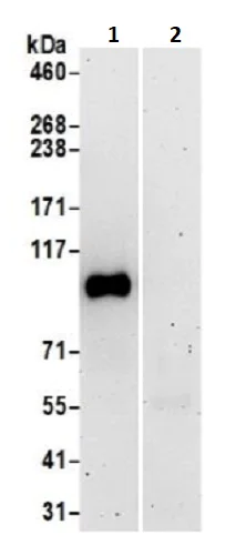 Immunoprecipitation - Anti-STIM2 antibody (AB241510)