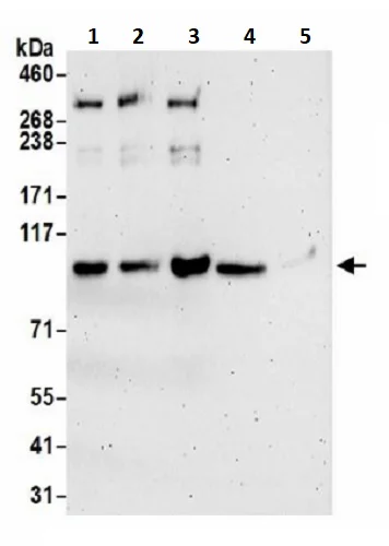 Western blot - Anti-STIM2 antibody (AB241510)