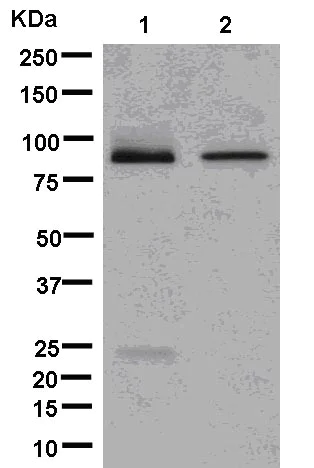 Western blot - Anti-STIM2 antibody [EPR12879] - C-terminal (AB181258)