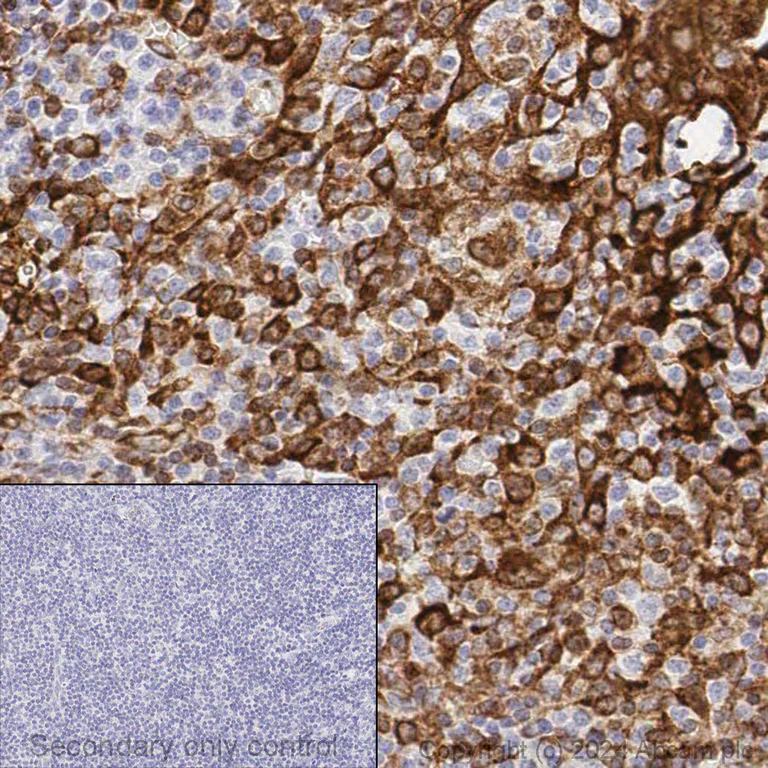 Immunohistochemistry (Formalin/PFA-fixed paraffin-embedded sections) - Anti-STING antibody [EPR13130-55] (AB239074)