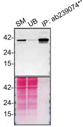 Immunoprecipitation - Anti-STING antibody [EPR13130-55] - BSA and Azide free (AB242019)