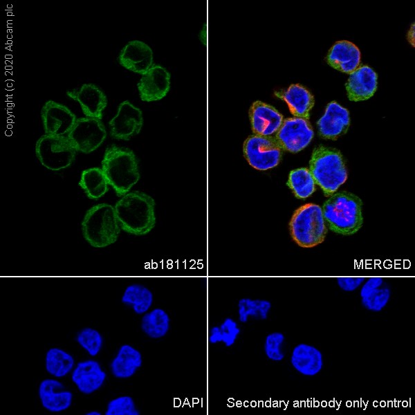 Immunocytochemistry/ Immunofluorescence - Anti-STING antibody [EPR13130] (AB181125), expandable thumbnail