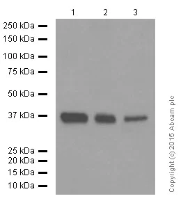Western blot - Anti-STING antibody [EPR13130] (AB181125)
