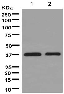 Western blot - Anti-STING antibody [EPR13130] (ab181125), expandable thumbnail