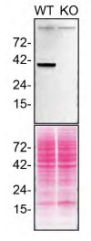Western blot - Anti-STING antibody [EPR13130] (ab181125), expandable thumbnail
