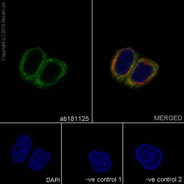 Immunocytochemistry/ Immunofluorescence - Anti-STING antibody [EPR13130] - BSA and Azide free (AB227128)