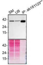 Immunoprecipitation - Anti-STING antibody [EPR13130] - BSA and Azide free (AB227128)