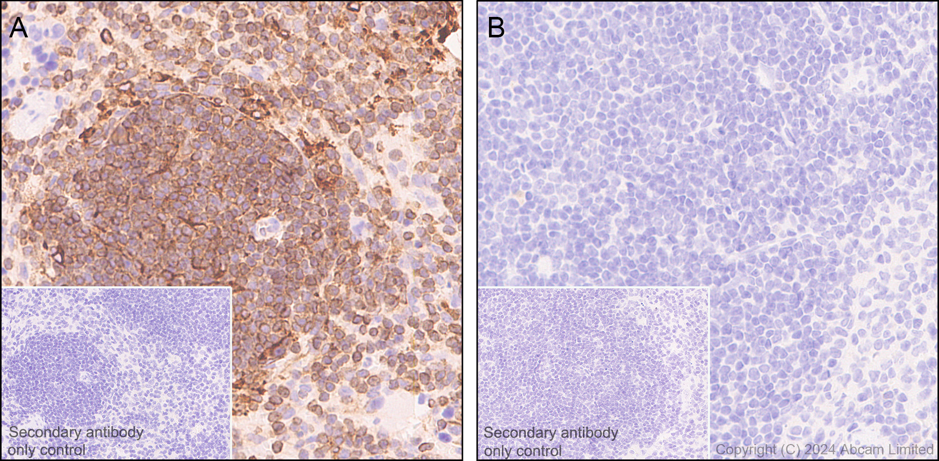 Immunohistochemistry (Formalin/PFA-fixed paraffin-embedded sections) - Anti-STING antibody [EPR25090-107] - BSA and Azide free (ab288164), expandable thumbnail