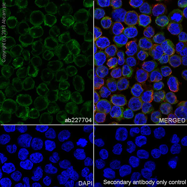 Immunocytochemistry/ Immunofluorescence - Anti-STING antibody [SP338] (AB227704)