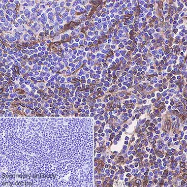 Immunohistochemistry (Formalin/PFA-fixed paraffin-embedded sections) - Anti-STING antibody [SP338] (AB227704)