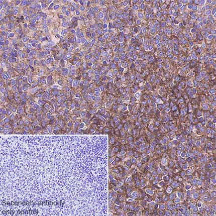 Immunohistochemistry (Formalin/PFA-fixed paraffin-embedded sections) - Anti-STING antibody [SP338] (AB227704)