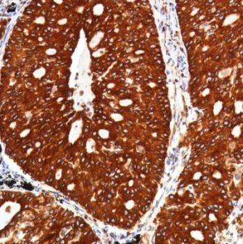 Immunohistochemistry (Formalin/PFA-fixed paraffin-embedded sections) - Anti-STING antibody [SP338] (AB227704)