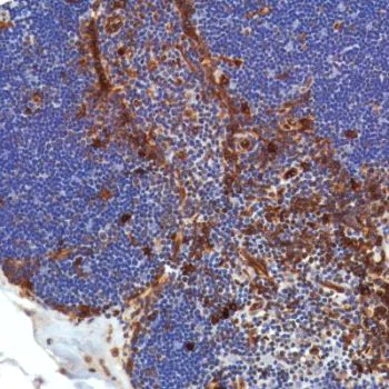 Immunohistochemistry (Formalin/PFA-fixed paraffin-embedded sections) - Anti-STING antibody [SP338] (AB227704)