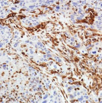 Immunohistochemistry (Formalin/PFA-fixed paraffin-embedded sections) - Anti-STING antibody [SP338] (AB227704)