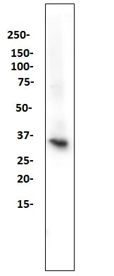Western blot - Anti-STING antibody [SP338] (AB227704)
