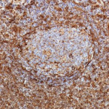 Immunohistochemistry (Formalin/PFA-fixed paraffin-embedded sections) - Anti-STING antibody [SP338] - BSA and Azide free (AB238795)
