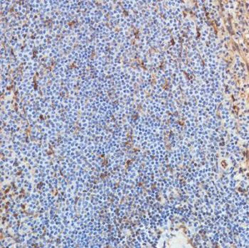 Immunohistochemistry (Formalin/PFA-fixed paraffin-embedded sections) - Anti-STING antibody [SP338] - BSA and Azide free (AB238795)