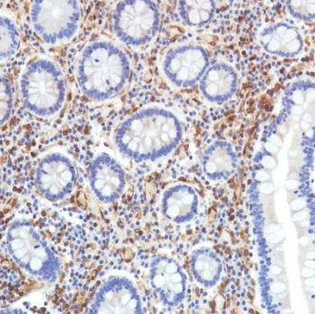 Immunohistochemistry (Formalin/PFA-fixed paraffin-embedded sections) - Anti-STING antibody [SP338] - BSA and Azide free (AB238795)