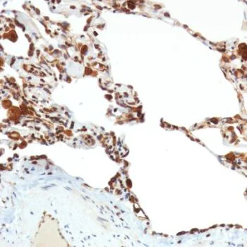 Immunohistochemistry (Formalin/PFA-fixed paraffin-embedded sections) - Anti-STING antibody [SP338] - BSA and Azide free (AB238795)