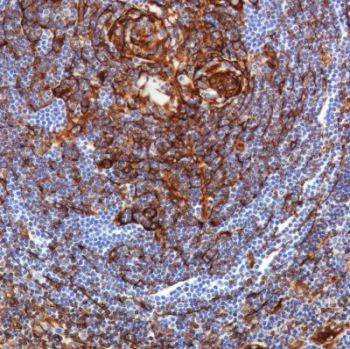 Immunohistochemistry (Formalin/PFA-fixed paraffin-embedded sections) - Anti-STING antibody [SP338] - BSA and Azide free (AB238795)