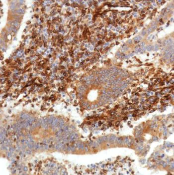Immunohistochemistry (Formalin/PFA-fixed paraffin-embedded sections) - Anti-STING antibody [SP338] - BSA and Azide free (AB238795)