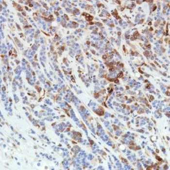 Immunohistochemistry (Formalin/PFA-fixed paraffin-embedded sections) - Anti-STING antibody [SP338] - BSA and Azide free (AB238795)