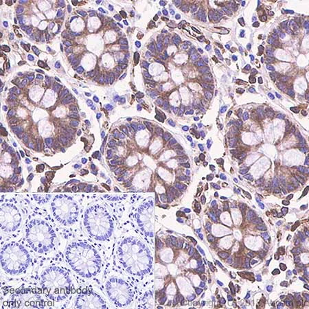 Immunohistochemistry (Formalin/PFA-fixed paraffin-embedded sections) - Anti-STING antibody [SP338] - BSA and Azide free (AB238795)