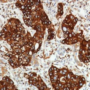 Immunohistochemistry (Formalin/PFA-fixed paraffin-embedded sections) - Anti-STING antibody [SP338] - BSA and Azide free (AB238795)