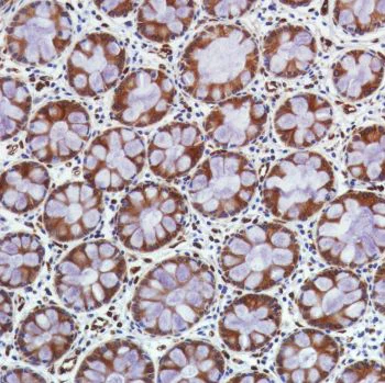 Immunohistochemistry (Formalin/PFA-fixed paraffin-embedded sections) - Anti-STING antibody [SP339] (AB227705)