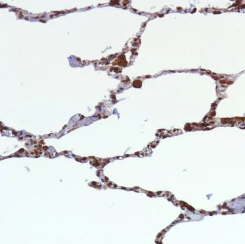 Immunohistochemistry (Formalin/PFA-fixed paraffin-embedded sections) - Anti-STING antibody [SP339] (AB227705)