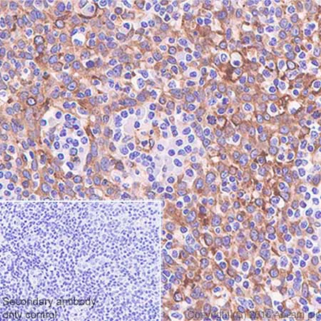 Immunohistochemistry (Formalin/PFA-fixed paraffin-embedded sections) - Anti-STING antibody [SP339] (AB227705)
