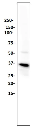 Western blot - Anti-STING antibody [SP339] (AB227705)