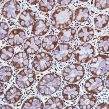 Immunohistochemistry (Formalin/PFA-fixed paraffin-embedded sections) - Anti-STING antibody [SP339] - BSA and Azide free (ab238796), expandable thumbnail