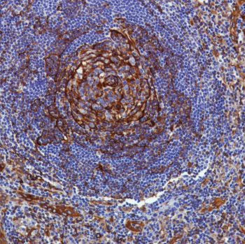 Immunohistochemistry (Formalin/PFA-fixed paraffin-embedded sections) - Anti-STING antibody [SP339] - BSA and Azide free (AB238796)