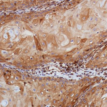 Immunohistochemistry (Formalin/PFA-fixed paraffin-embedded sections) - Anti-STING antibody [SP339] - BSA and Azide free (ab238796), expandable thumbnail