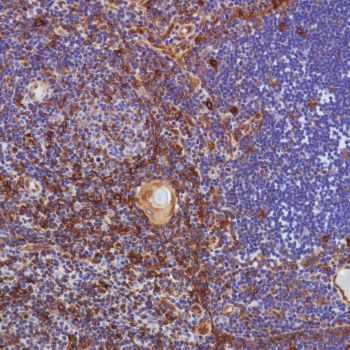 Immunohistochemistry (Formalin/PFA-fixed paraffin-embedded sections) - Anti-STING antibody [SP339] - BSA and Azide free (AB238796), expandable thumbnail