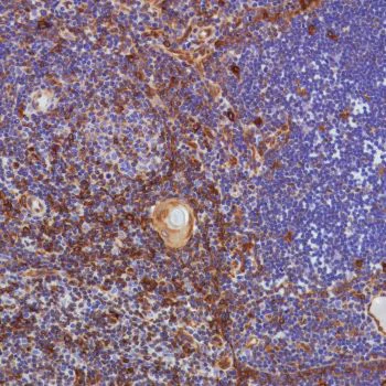Immunohistochemistry (Formalin/PFA-fixed paraffin-embedded sections) - Anti-STING antibody [SP339] - BSA and Azide free (AB238796)