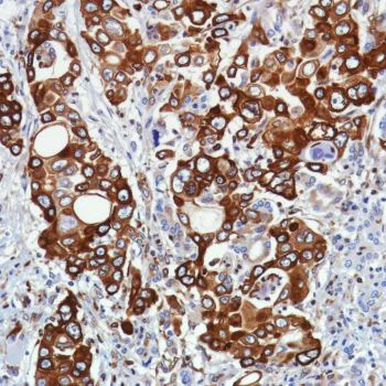 Immunohistochemistry (Formalin/PFA-fixed paraffin-embedded sections) - Anti-STING antibody [SP339] - BSA and Azide free (AB238796)