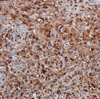 Immunohistochemistry (Formalin/PFA-fixed paraffin-embedded sections) - Anti-STING antibody [SP339] - BSA and Azide free (ab238796), expandable thumbnail