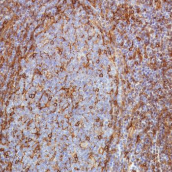 Immunohistochemistry (Formalin/PFA-fixed paraffin-embedded sections) - Anti-STING antibody [SP339] - BSA and Azide free (AB238796), expandable thumbnail