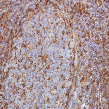 Immunohistochemistry (Formalin/PFA-fixed paraffin-embedded sections) - Anti-STING antibody [SP339] - BSA and Azide free (AB238796)